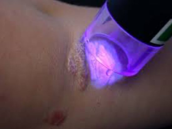 XTRAC Laser Therapy